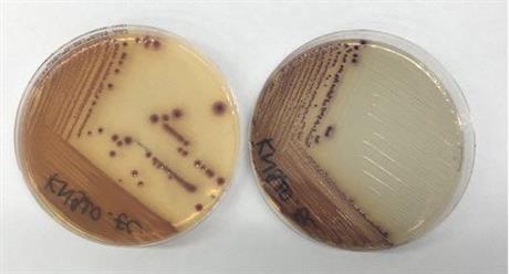 Phát triển đĩa thạch ChromAgar CRE